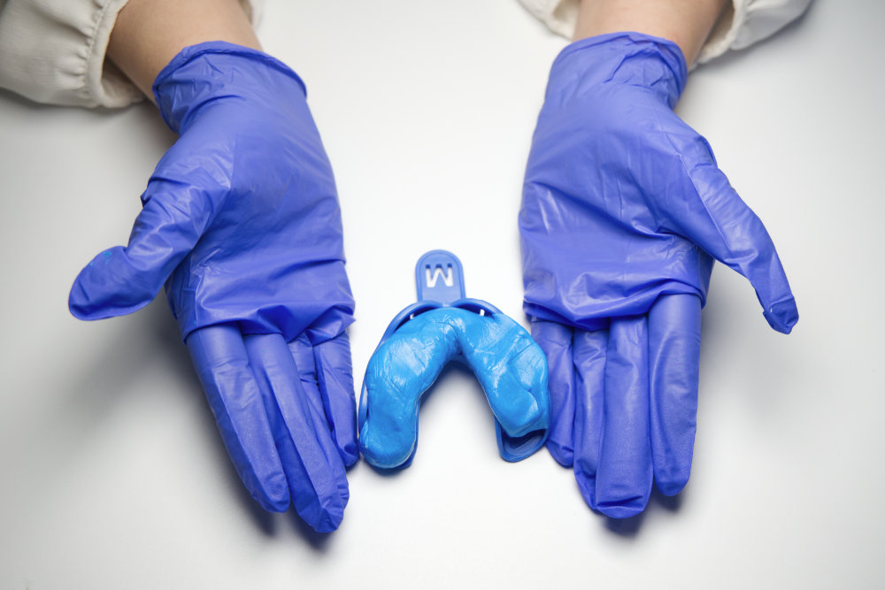 A woman's hand showing the Smiles.CLub's impression putty pushed into the first impression tray.