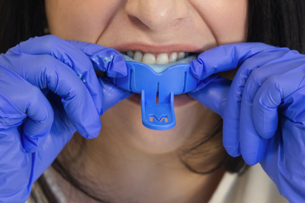 A woman wearing gloves removing an upper Smiles.Club impression kit tray.