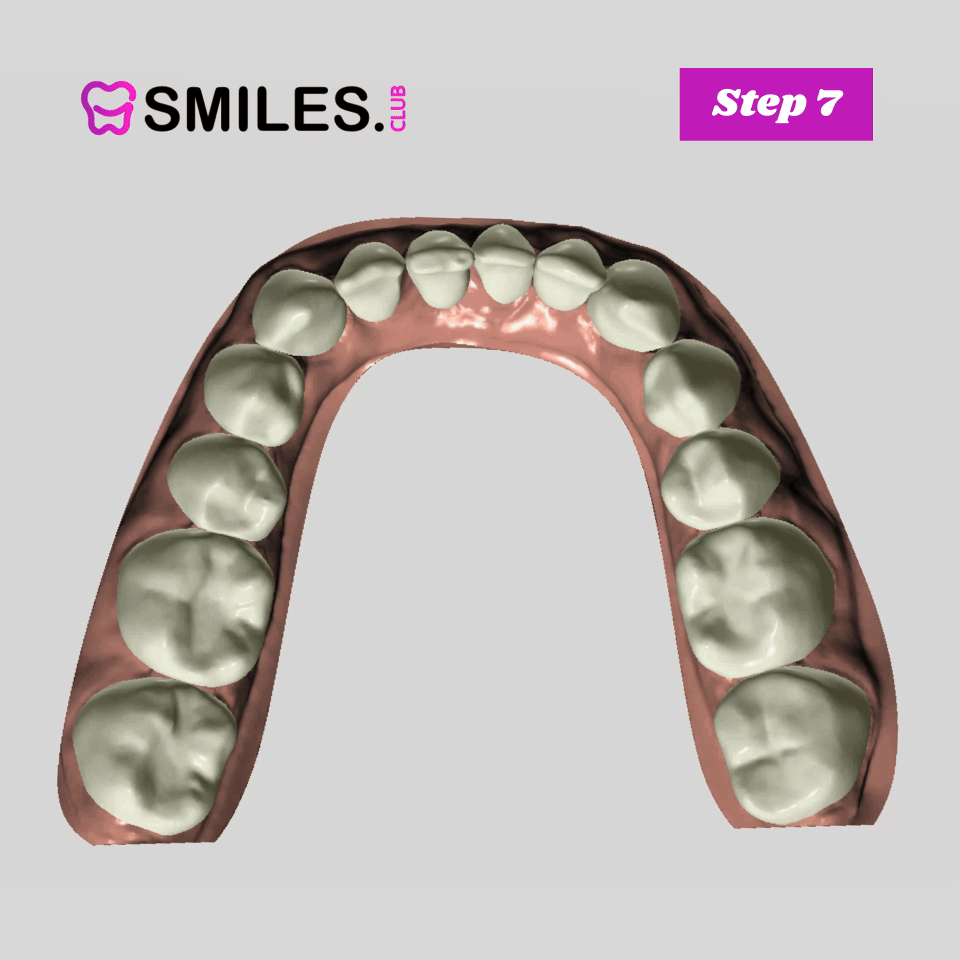 Clear Aligner Step 7 mouth moving aimation