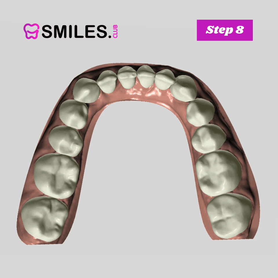 Clear Aligner Step 8 mouth moving aimation