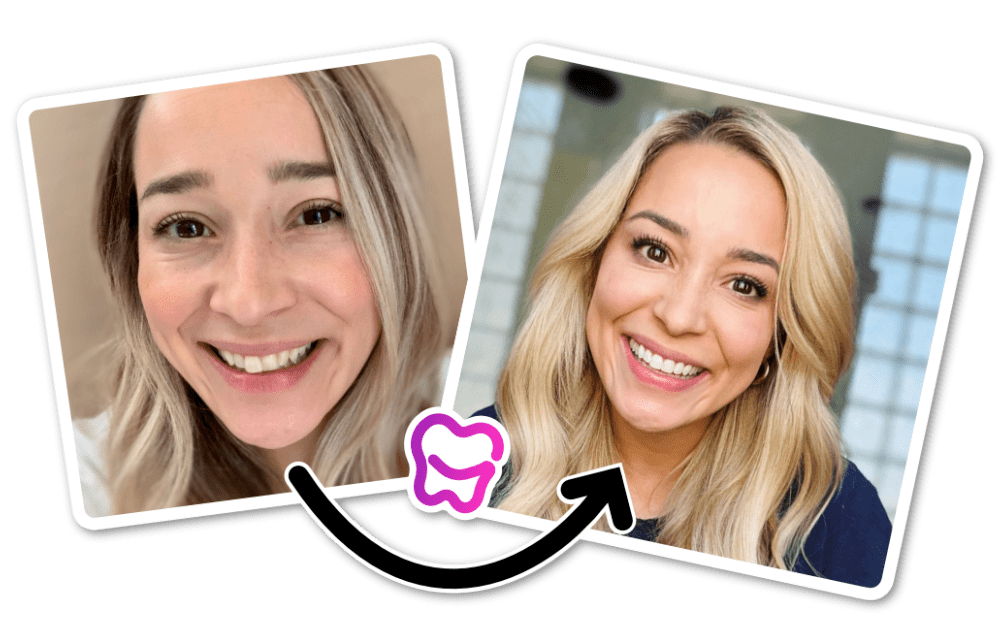 women researching clear aligners on her laptop