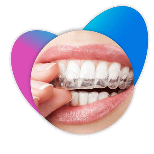 A woman's smile pulling out her clear aligners.